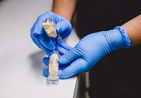 Bite model for designing metal free dental restorations