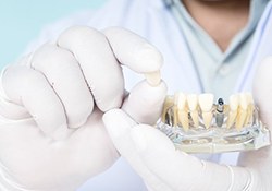 Dentist holding a restoration for dental implants in Geneva