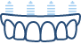 Animated implant supported denture