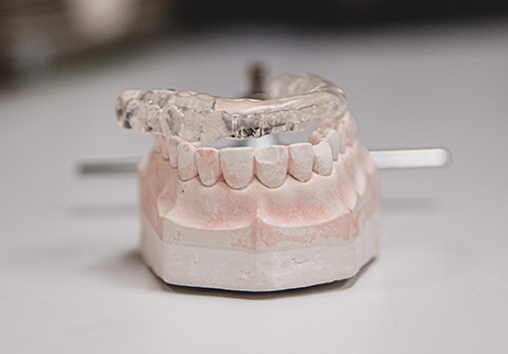 Model smile with occlusal splint for T M J Therapy